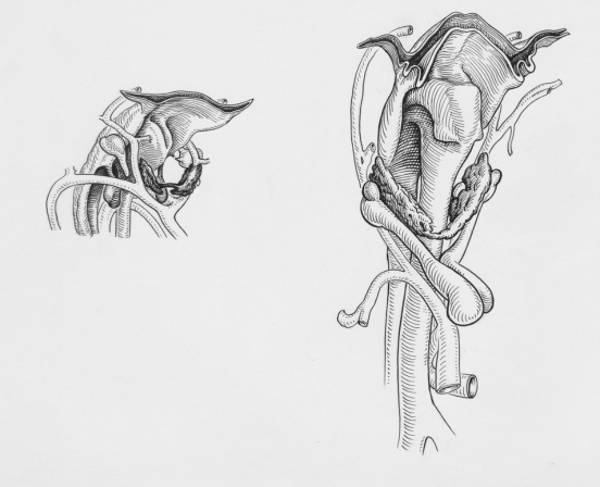 Abstract Art Sketch
